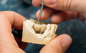 dental ceramics lab dental technology kelowna schack dental implants